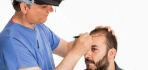 Saç Ekimi Kimlere Uygulanır, Kimlere Uygulanmaz